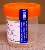 Sterile Orange Top Container (orange-top-container.jpg)