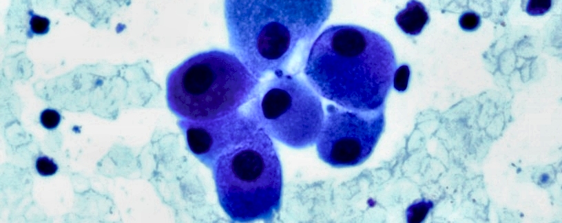 Cells under magnification (00000158.jpg)